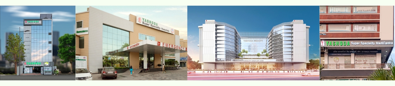 Image of Yashoda Super Speciality Hospitals' four facilities: Yashoda Medicity, Yashoda Hospital Kaushambi, Yashoda Karkardooma, and Yashoda Meerut.